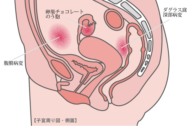 子宮周り図
